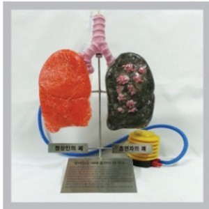 보건교구 살아있는 폐와 흡연자 폐 비교 키트(B형)[kim3-439]