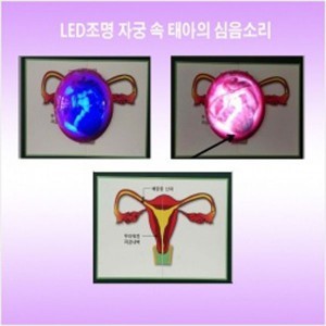 성보건교구 LED조명 자궁 속 태아의 심음소리(kim3-505)